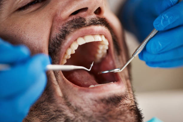 Best Urgent Dental Care for Toothaches in Vilge St George, LA