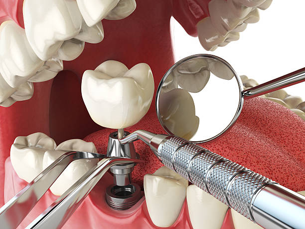 Best Emergency Orthodontic Repairs in Vilge St George, LA